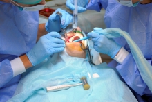 Fakty z historii implantów dentystycznych