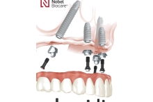 Імпланти Nobel Biocare