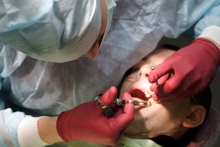 Terminy wszczepienia implantów