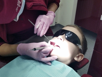 професійна гігієна зубів у дітей
