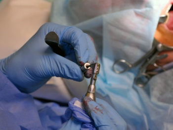 Gwarancją długotrwałego funkcjonowania implantu jest tworzenie strefy buforowej wokół implantu