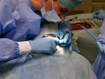 Implantacja zębów
