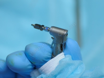 Implanty Nobel Biocare
