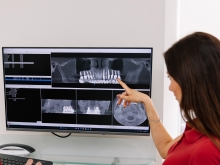 зубні імплантати